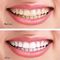 پودر سفید کننده دندان های طبیعی نارگیل برای پاک کردن دندان های دندان
